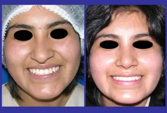 aramayo_01