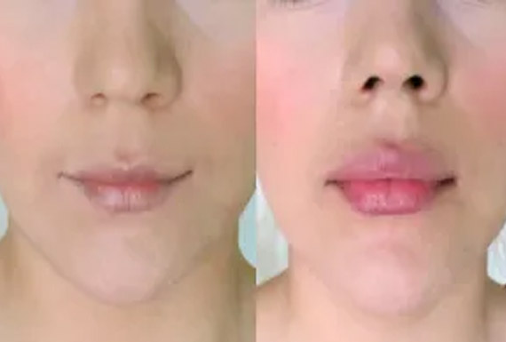 aramayo_02